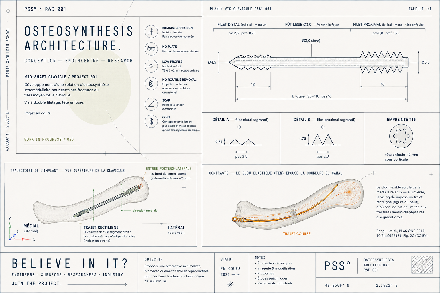 Plan technique PSS° d’une vis d’ostéosynthèse intramédullaire pour fracture du tiers moyen de la clavicule